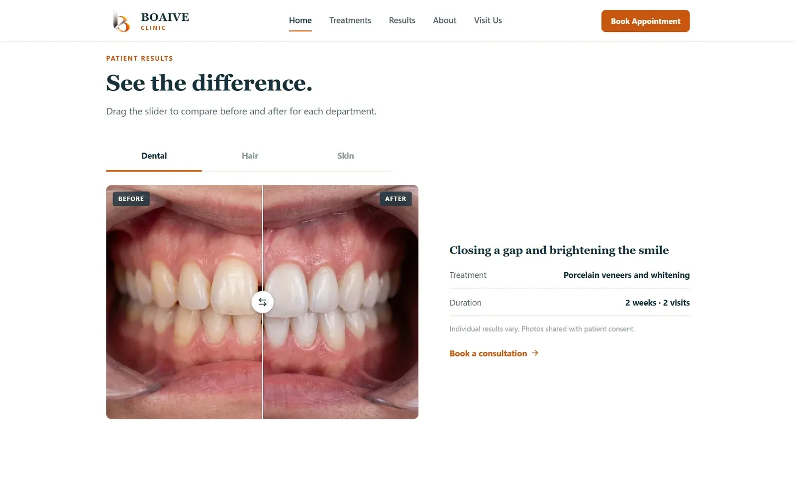 Clinic before and after comparison slider